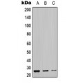 LifeSab™ LYPLA1 Rabbit pAb (50 µl)