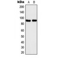 LifeSab™ Kanadaptin Rabbit pAb (50 µl)