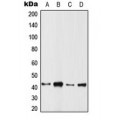 LifeSab™ ARFIP1 Rabbit pAb (50 µl)
