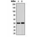 LifeSab™ ADPGK Rabbit pAb (50 µl)