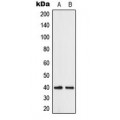 LifeSab™ ABHD12B Rabbit pAb (50 µl)