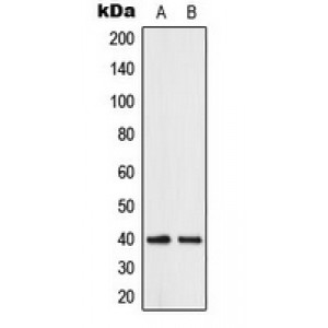 LifeSab™ ABHD12B Rabbit pAb (50 µl)
