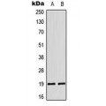 LifeSab™ LATH Rabbit pAb (50 µl)