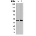 LifeSab™ FOXC1/2 Rabbit pAb (50 µl)