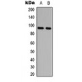LifeSab™ AMPD2 Rabbit pAb (50 µl)