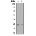 LifeSab™ p27 Kip1 (pT187) Rabbit pAb (50 µl)