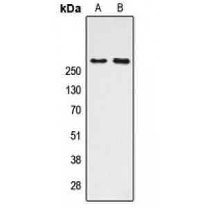 LifeSab™ CBP (AcK1535) Rabbit pAb (50 µl)
