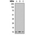 LifeSab™ Cystatin 1 Rabbit pAb (50 µl)