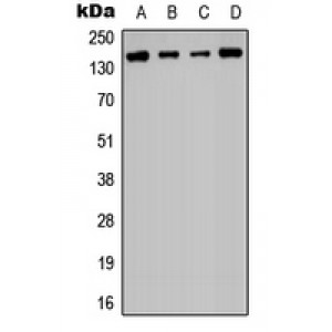 LifeSab™ Histone Deacetylase 6 Rabbit pAb (50 µl)