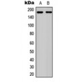LifeSab™ RET (pY1062) Rabbit pAb (50 µl)