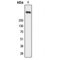 LifeSab™ Ryanodine Receptor 2 (pS2808) Rabbit pAb (50 µl)