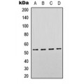 LifeSab™ p53 Rabbit pAb (50 µl)