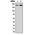 LifeSab™ EGFR Rabbit pAb (50 µl)