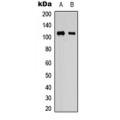 LifeSab™ KSR1 Rabbit pAb (50 µl)