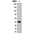 LifeSab™ Delta Opioid Receptor (pS363) Rabbit pAb (50 µl)
