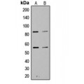 LifeSab™ PI3K p85 alpha/p55 gamma (pY467/199) Rabbit pAb (50 µl)