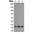 LifeSab™ DARPP32 (pT34) Rabbit pAb (50 µl)