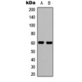LifeSab™ WASP (pY290) Rabbit pAb (50 µl)