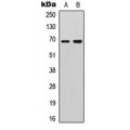 LifeSab™ DDX5 (pY593) Rabbit pAb (50 µl)