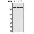 LifeSab™ CD222 Rabbit pAb (50 µl)