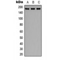 LifeSab™ IRS1 Rabbit pAb (50 µl)