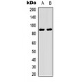 LifeSab™ TRK A (pY496) Rabbit pAb (50 µl)