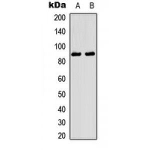 LifeSab™ TRK A (pY496) Rabbit pAb (50 µl)