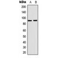 LifeSab™ Progesterone Receptor Rabbit pAb (50 µl)
