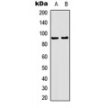 LifeSab™ RSK1/2/3 (pT573/570/577) Rabbit pAb (50 µl)