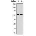 LifeSab™ STEAP4 Rabbit pAb (50 µl)