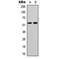 LifeSab™ p53 (pS20) Rabbit pAb (50 µl)