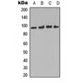 LifeSab™ FOXO3 (pS253) Rabbit pAb (50 µl)