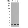 LifeSab™ CBFB Rabbit pAb (50 µl)