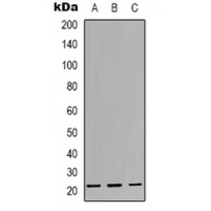 LifeSab™ CBFB Rabbit pAb (50 µl)