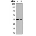 LifeSab™ DOK6 Rabbit pAb (50 µl)