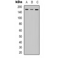 LifeSab™ IRS1 (pS312) Rabbit pAb (50 µl)