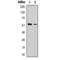 LifeSab™ Dematin Rabbit pAb (50 µl)