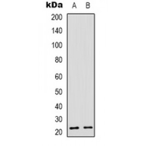 LifeSab™ Recoverin Rabbit pAb (50 µl)