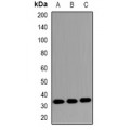 LifeSab™ MKI67IP (pT234) Rabbit pAb (50 µl)