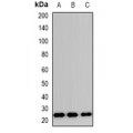 LifeSab™ TP53INP2 Rabbit pAb (50 µl)