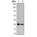 LifeSab™ Granzyme A Rabbit pAb (50 µl)