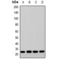 LifeSab™ ZNRF2 Rabbit pAb (50 µl)