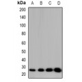 LifeSab™ CIDEB Rabbit pAb (50 µl)