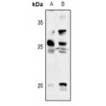 LifeSab™ Thymidine Kinase 1 Rabbit pAb (50 µl)
