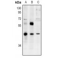 LifeSab™ ZNF392 Rabbit pAb (50 µl)