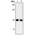 LifeSab™ GFM2 Rabbit pAb (50 µl)