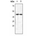 LifeSab™ CRKL Rabbit pAb (50 µl)