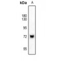 LifeSab™ SYK Rabbit pAb (50 µl)