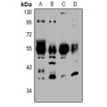 LifeSab™ NTR2 Rabbit pAb (50 µl)