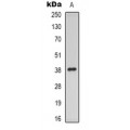 LifeSab™ mPR gamma Rabbit pAb (50 µl)
